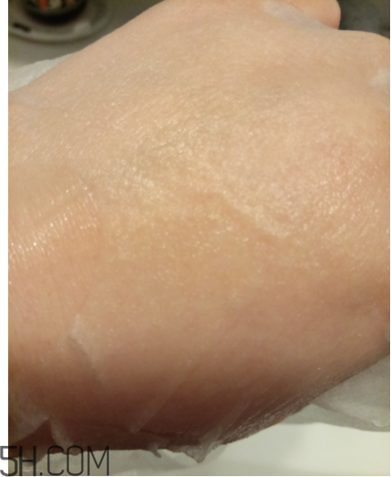 WIS痘肌修護(hù)面膜有效嗎？適合敏感肌嗎？