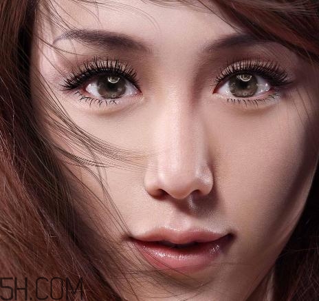 上瞼提肌手術(shù)有必要嗎？上瞼提肌后是永久的嗎？