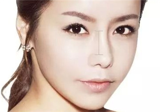 達(dá)拉斯隆鼻是什么材料？達(dá)拉斯隆鼻怎么樣？