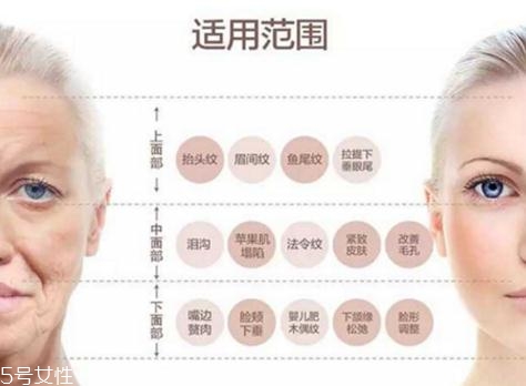 大v線會(huì)斷嗎？一定要選擇正規(guī)整形醫(yī)院