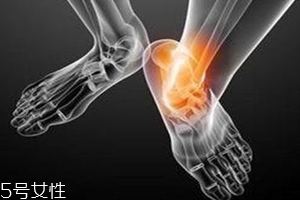 痛風跟飲食有關？痛風更多與遺傳有關