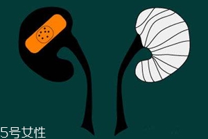 腎病為什么會發(fā)展到尿毒癥？這些因素一定要注意
