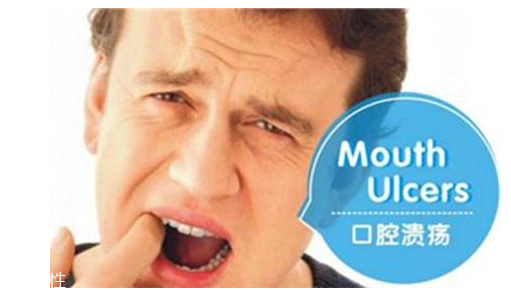 潰瘍的根源在哪里？也許僅僅只是牙膏沒選對