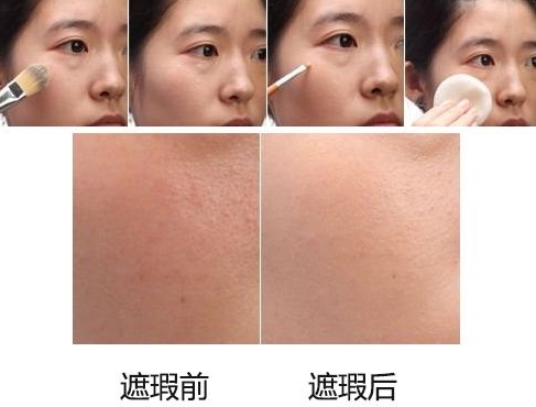 遮瑕膏可以遮痘印和痘坑嗎？推薦幾款遮瑕產品