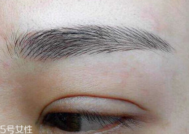 激光洗眉恢復(fù)期有疤痕怎么辦？激光洗眉毛之后正確護理方法