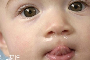 冬季寶寶流鼻涕是什么原因？教你幾招輕松應(yīng)對