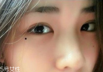 痣越多越長(zhǎng)壽嗎？身上最有福氣的吉痣