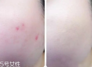 cpb遮瑕棒怎么樣？來看看使用效果