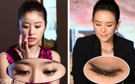 內(nèi)雙怎么進(jìn)化成雙眼皮？全是雙眼皮貼的功勞