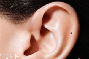 臉上哪些痣不能去掉？這些痣不能隨便祛掉