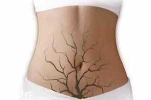 體內(nèi)毒素超標(biāo)有何表現(xiàn)？五大癥狀須注意