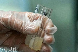 捐精有什么危害？專家稱沒有危害