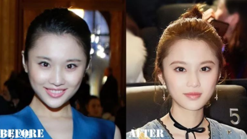 瑯琊榜2張慧雯整容了嗎？換了妝發(fā)美到不認(rèn)識