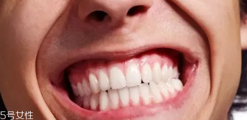 磨牙是因為受了委屈？孩子的心理狀況也會導(dǎo)致磨牙