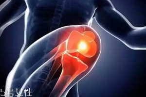 關(guān)節(jié)有響聲是病嗎？?jī)煞N情況區(qū)別對(duì)待