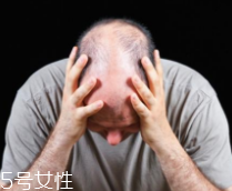 脫發(fā)有沒有治？只要不是禿子就有得治