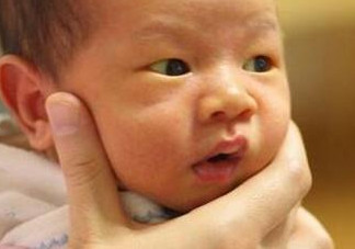 新生兒長黃疸怎么辦？有些黃疸癥狀媽媽們可別忽視