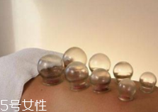 拔火罐引火上身的原因是什么？這4點要注意