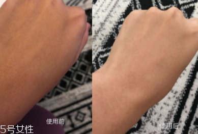 美白精華只能晚上用嗎？白天要做好防曬
