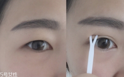 雙眼皮貼一般多少錢？