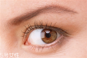 開眼角會影響視力嗎？開眼角會有危害
