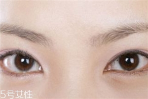 割雙眼皮后怎樣恢復快？女人不能割雙眼皮的時期