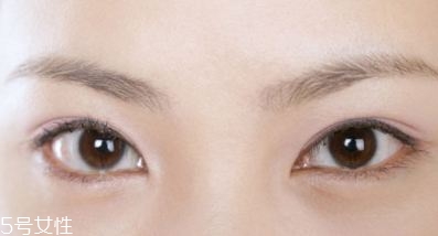 割雙眼皮的術(shù)前準(zhǔn)備有哪些？割雙眼皮的常見做法