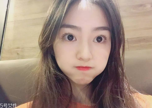割雙眼皮要注意什么？割雙眼皮充血是正?，F(xiàn)象