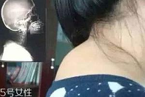 富貴包是什么??？姿態(tài)優(yōu)美少犯病