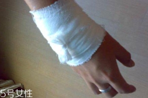 被蜈蚣咬傷后能治愈嗎？科學家有新發(fā)現(xiàn)