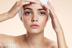 痘痘反復(fù)長是什么原因？基礎(chǔ)護膚不夠用心