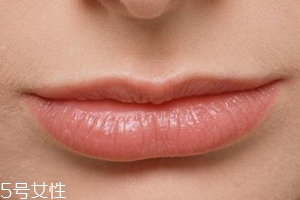 嘴唇干裂是一種病嗎？治療口角炎從改善習慣入手
