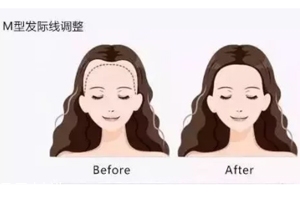 發(fā)際線粉填充和發(fā)際線筆哪個(gè)好？配合使用才最完美