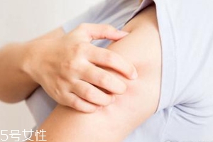 身體皮膚干燥用什么護(hù)膚品？這些身體乳拯救爆皮掉屑
