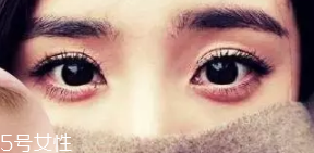 臥蠶和眼袋的區(qū)別是什么？臥蠶是肌肉眼袋是肥肉