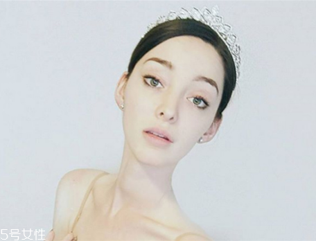 法令紋填充需要幾只玻尿酸？千萬不可過量