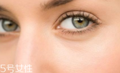 黑眼圈很重是什么原因？深扒三類黑眼圈的成因