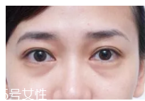 黑眼圈用什么眼霜好？多效護(hù)理型眼霜是首選