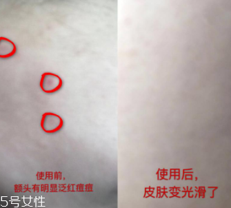 資生堂紅腰子適合什么年齡？最適合30歲以下人群