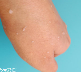 rosette去角質(zhì)凝膠怎么樣？真正的去角質(zhì)產(chǎn)品