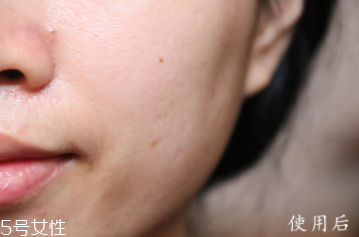 悅木之源和伊麗莎白雅頓哪個(gè)好？兩款精華大比拼