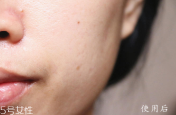 悅木之源和伊麗莎白雅頓哪個(gè)好？兩款精華大比拼