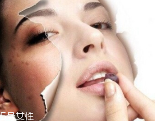 春季如何預(yù)防皮膚過敏？選擇敏感肌專用護膚品
