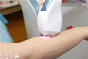 脫毛儀可以脫發(fā)際線嗎？脫了還會(huì)再長(zhǎng)