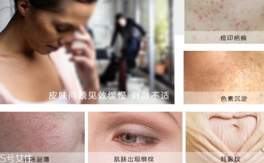 德國krauterhof蝸牛精華膏效果怎么樣？