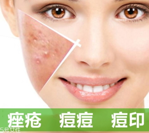 a酸怎么用？a酸怎么建立耐受？