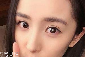 葉黃素能治療夜盲癥嗎？看什么類型的