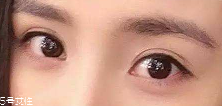 葉黃素能治療夜盲癥嗎？看什么類型的