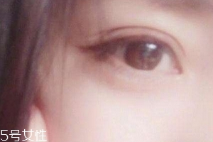 葉黃素一天吃多少毫克？按說明服用