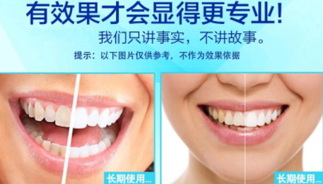 美白牙貼會(huì)反彈嗎？牙貼美白效果持續(xù)多久